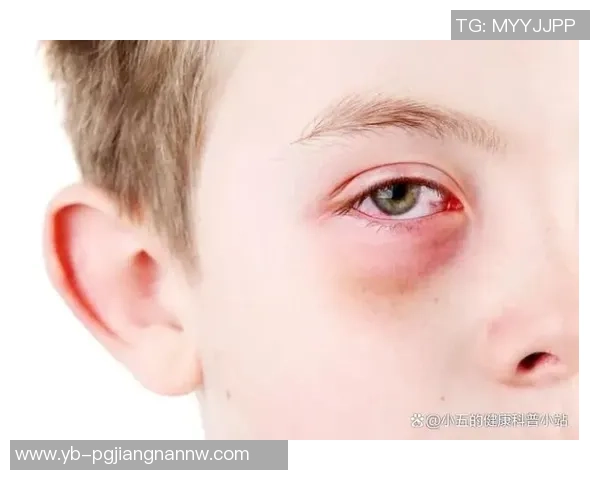 小卡解释鼻子出血原因只是轻微划伤并遭遇眼部意外碰撞